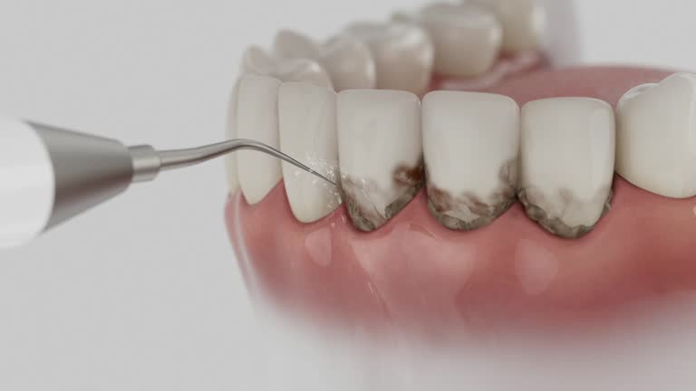 Trusted Teeth Cleaning And Checkup service in La Cañada Flintridge, CA - Dentist Open Now